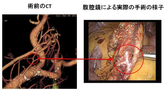 手術の様子の画像